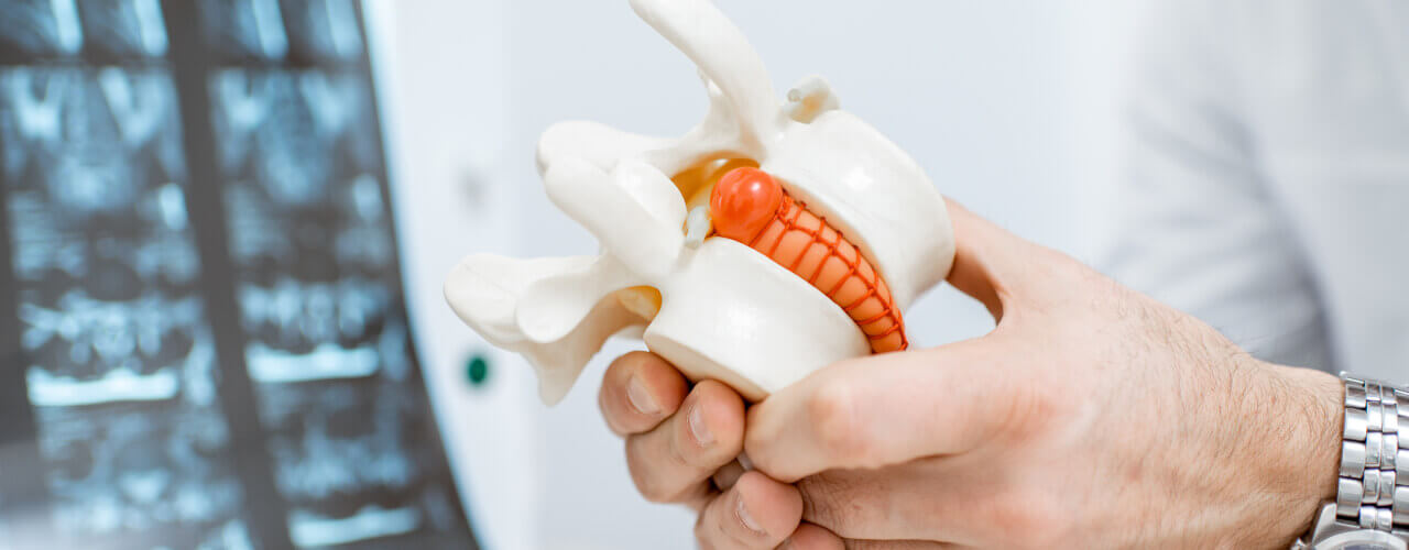Back Pain Can Have Many Causes – Could Yours Be From a Herniated Disc?