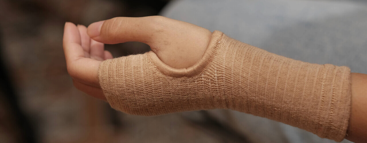 Managing Lymphedema After Cancer Treatment